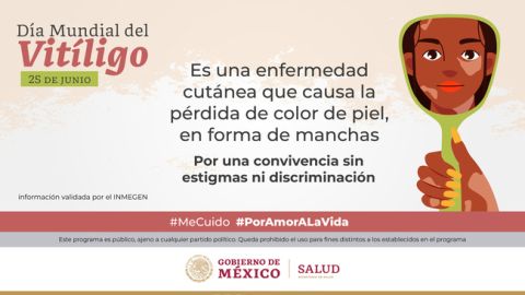 El Vitíligo es el tercer lugar en consultas dermatológicas; más de un millón de personas en México la padece