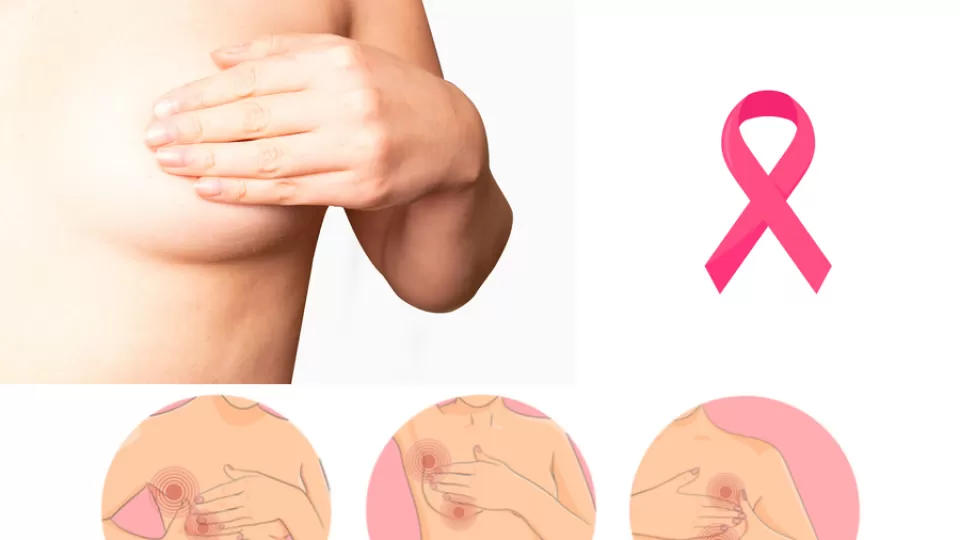 Cáncer de mama: guía esencial para la detección temprana. ¿A qué edad iniciar los chequeos y cuál es el momento ideal?