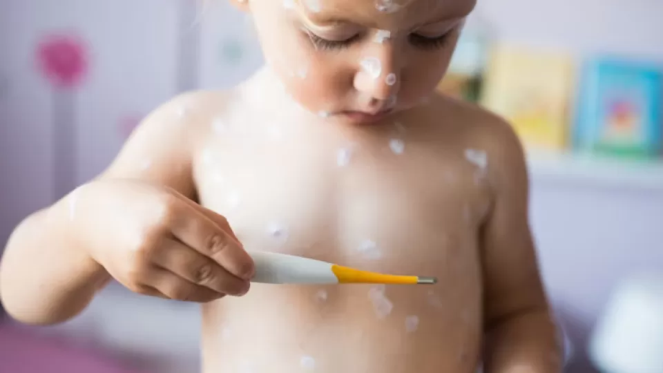 Alerta nacional por repunte de virus coxsackie: urge extremar precauciones en varias regiones