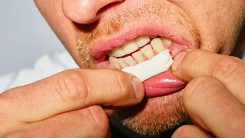 Saliva artificial de la UV Valparaíso revoluciona cuidado bucal para diabéticos: un avance antimicrobiano y regenerativo