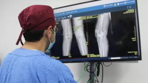 El IMSS incorpora cirugía robótica para reemplazo de rodilla que reduce sangrado, dolor y tiempo de recuperación