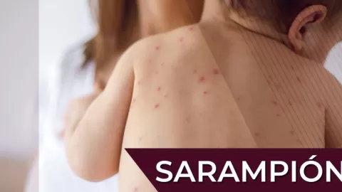 Sinaloa en Alerta Sanitaria: 52 Casos de Sarampión Importados en 2025, con Jornaleros Agrícolas como Foco Principal