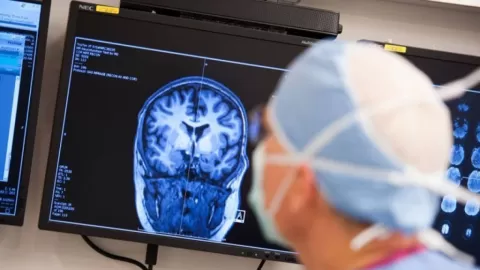 Epilepsia: Rompiendo el Silencio y el Estigma Social - Expertos Urgen a Eliminar Prejuicios para Mejorar la Calidad de Vida de los Pacientes