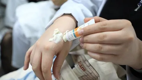 Impulsa IMSS capacitación médica para promover la fotoprotección y el cuidado de la piel desde la infancia